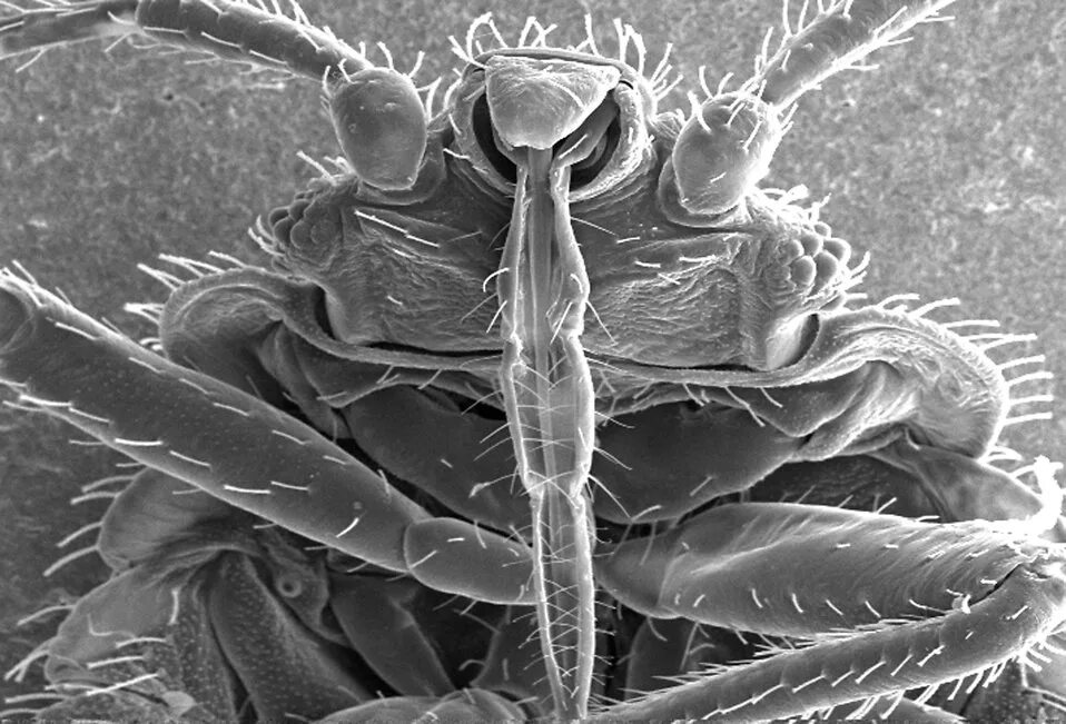 Клоп постельный под микроскопом фото The Bugs Behind The Bed Bug Genome