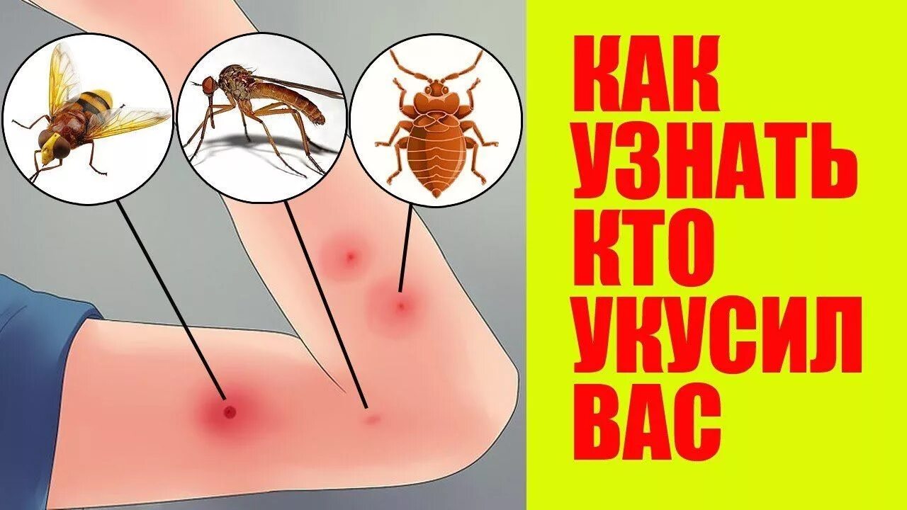 Клопиные укусы фото Топ 10 Укусов Насекомых, о Которых вы Обязаны Знать. ФОТО - смотреть видео онлай