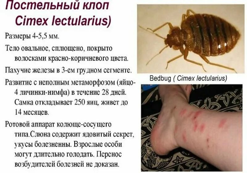 Клопов фото на коже человека Кто живет в постельном белье? Если ответ КЛОПЫ, вам не повезло