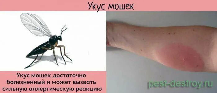 Клоповые укусы фото Укусы насекомых Частная поликлиника "Здоровейка" Липецк