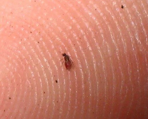 Клоповые укусы фото No-see-'um (Sand Fly) Beautiful bugs, Tiny flies, Ear massage