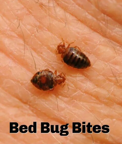 Клопы с кровью фото Don't let the bed bugs bite!