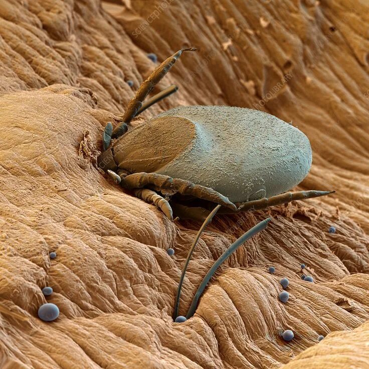 Клопы увеличенное фото Tick feeding on human blood, SEM - Stock Image - Z445/0498 - Science Photo Libra