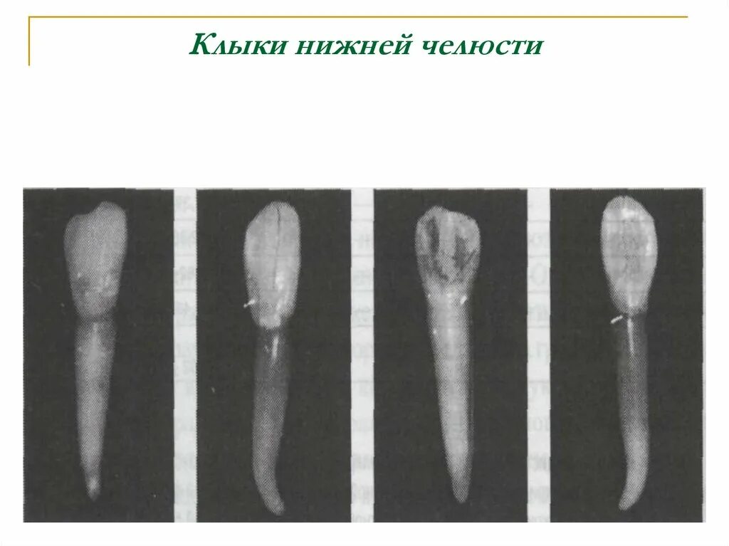 Клык верхней челюсти фото Зубочелюстно-лицевая система - единый анатомо-функциональный комплекс. Особеннос