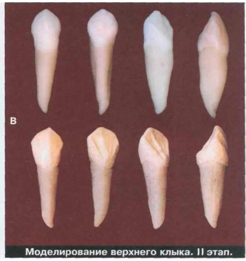 Клык зуб верхний фото МЕТОДОЛОГИЧЕСКИЕ ПОДХОДЫ В ХУДОЖЕСТВЕННОЙ СТОМАТОЛОГИИ