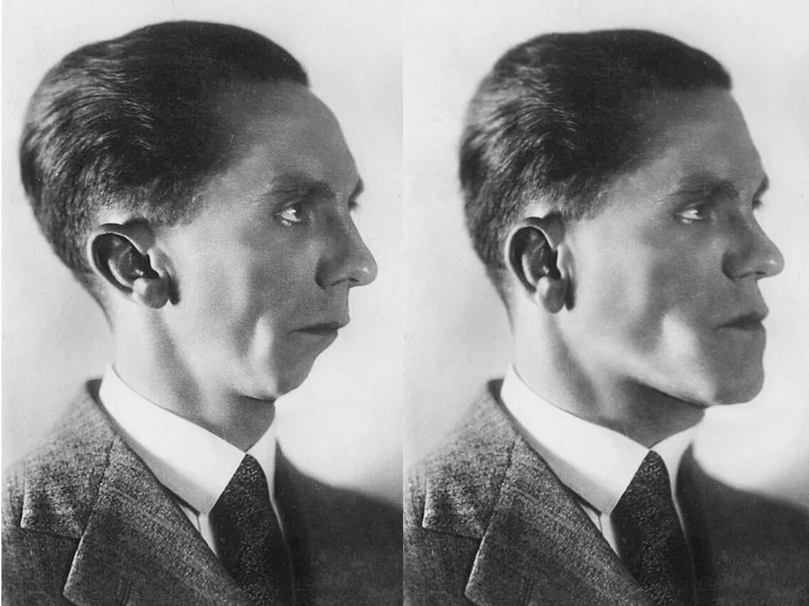 Ключ геббельса фото Before And After Surgery Goebbels Chin Edits Know Your Meme