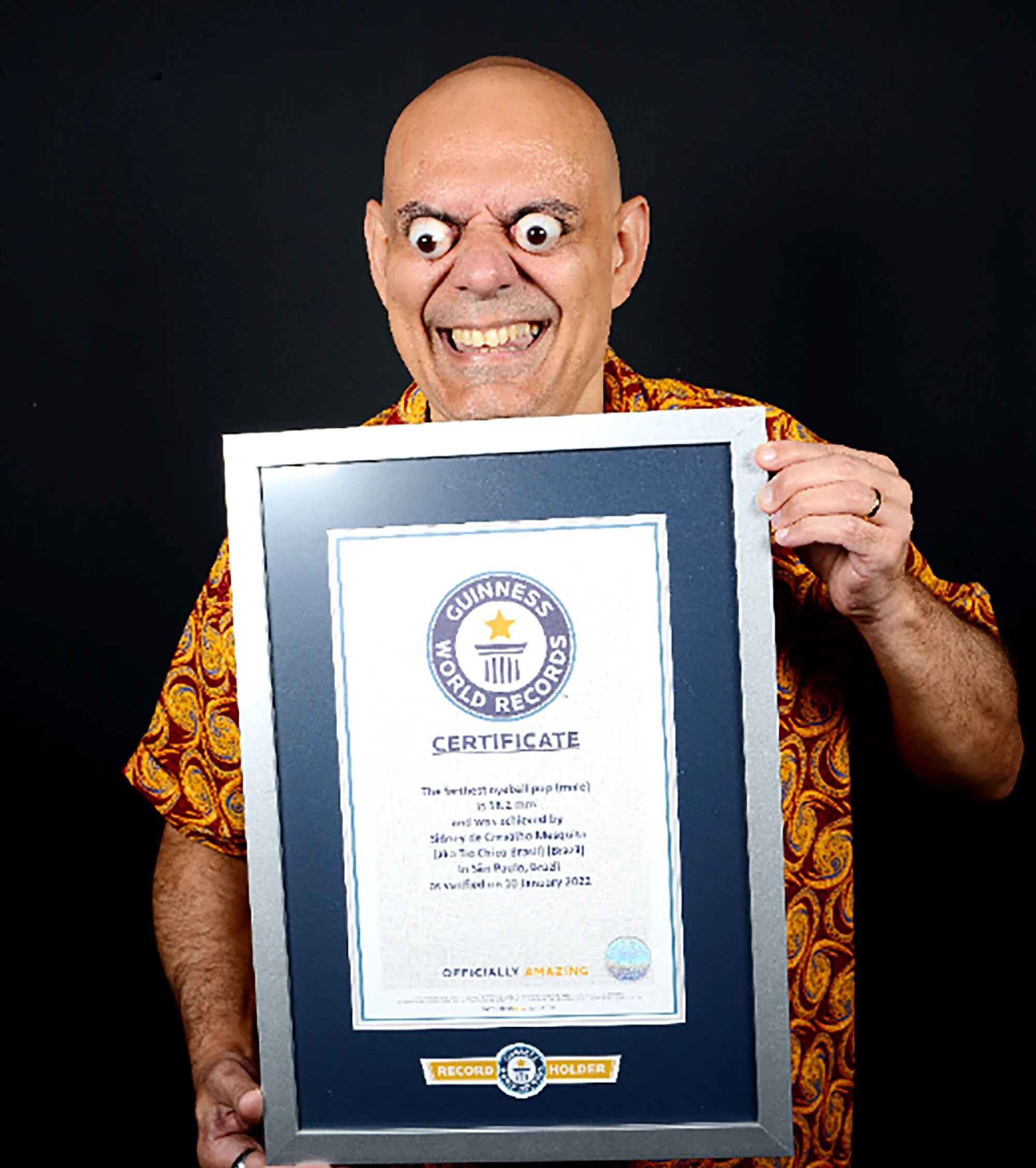 Книга рекордов фото с описанием Man breaks world record for farthest eyeball pop