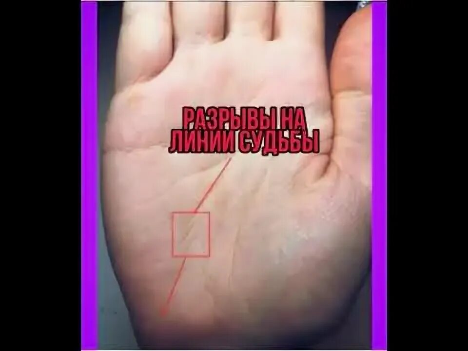 Квадраты на линии судьбы фото Разрывы на линии Судьбы - YouTube