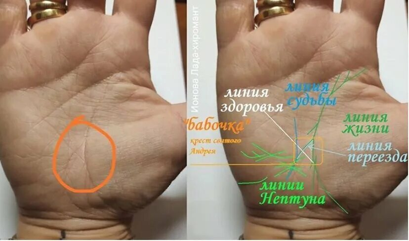 Квадраты на линии судьбы фото Подскажите, что означают кресты на обеих руках в центре ладони ❓ Хиромантия - за