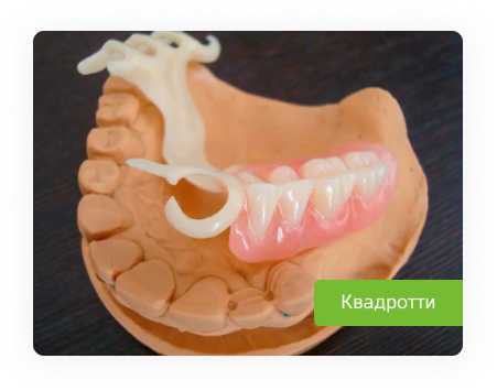 Квадротти на нижнюю челюсть фото Зубные протезы Квадротти: цены на установку, фото и описание - ROOTT