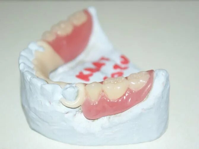 Квадротти на нижнюю челюсть фото Полные съемные протезы: съемные зубные протезы при полном отсутствии зубов, цена