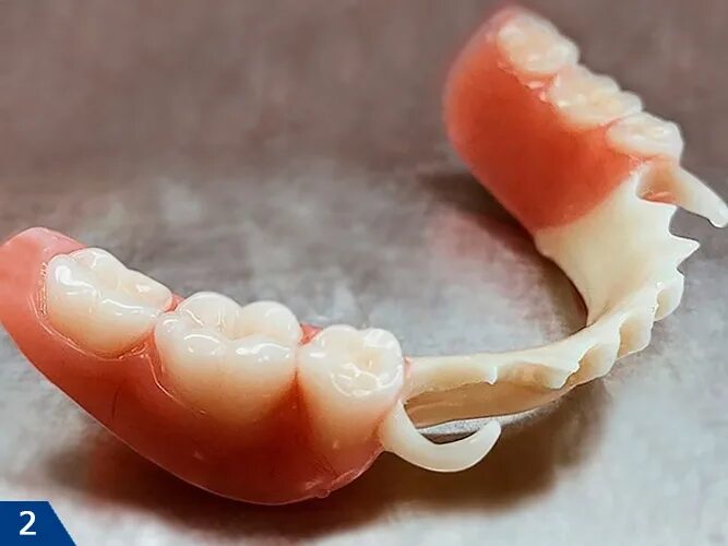 Квадротти на нижнюю челюсть фото Зубные протезы Квадротти (QuattroTi) - отзывы пациентов, фото