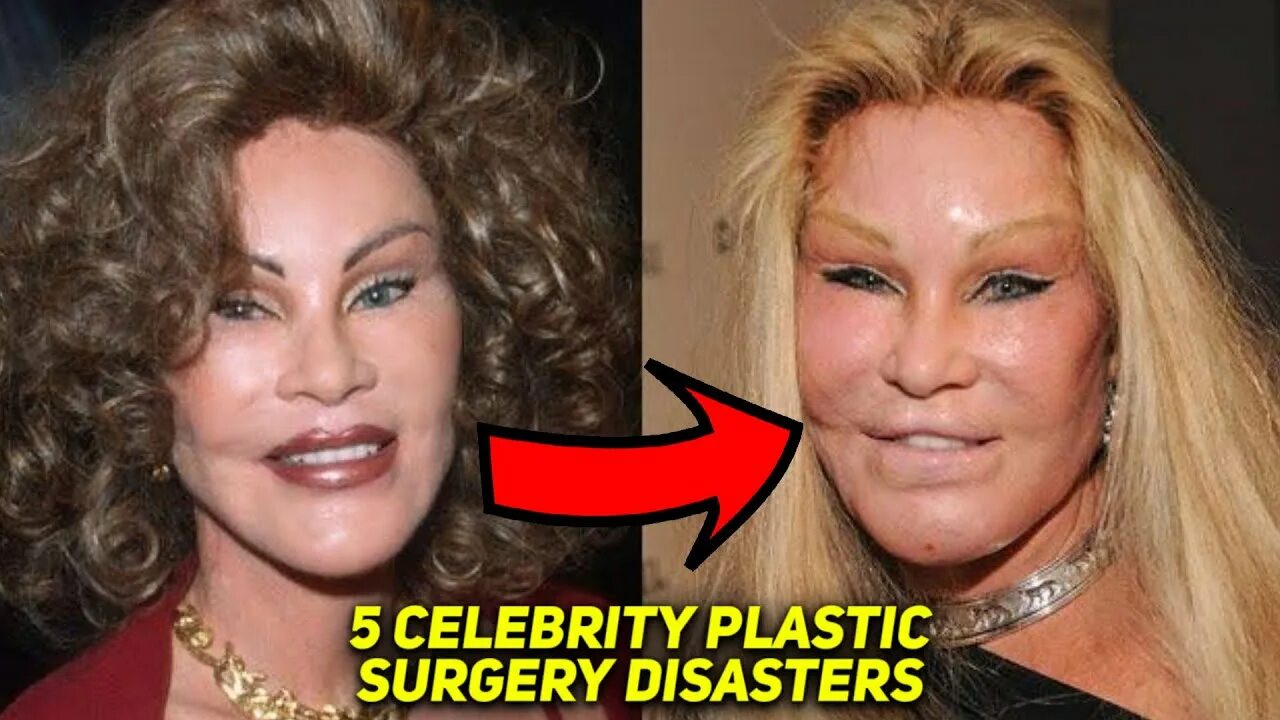 Квинсента фото до и после 5 Celebrity Plastic Surgery Disasters - YouTube