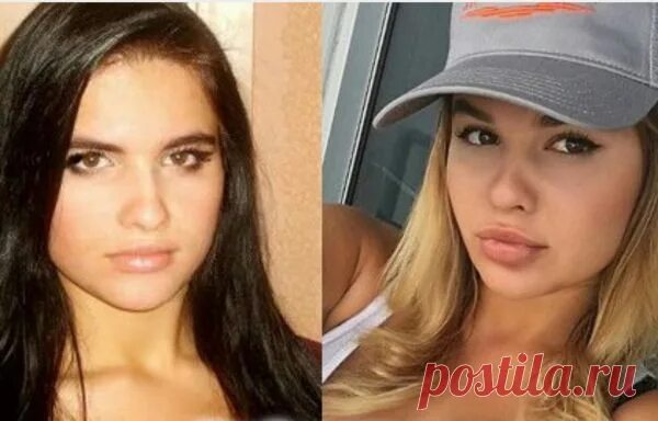 Квитко до и после пластики фото Как выглядит Анастасия Квитко до и после пластики: слив фото - QARI Интересно о 