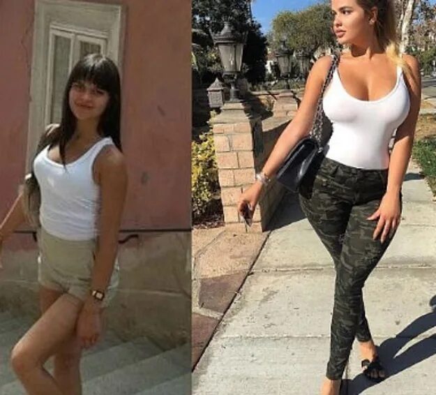 Квитко до и после пластики фото СМИ узнали, как раньше выглядела "русская Ким Кардашьян" - Экспресс газета