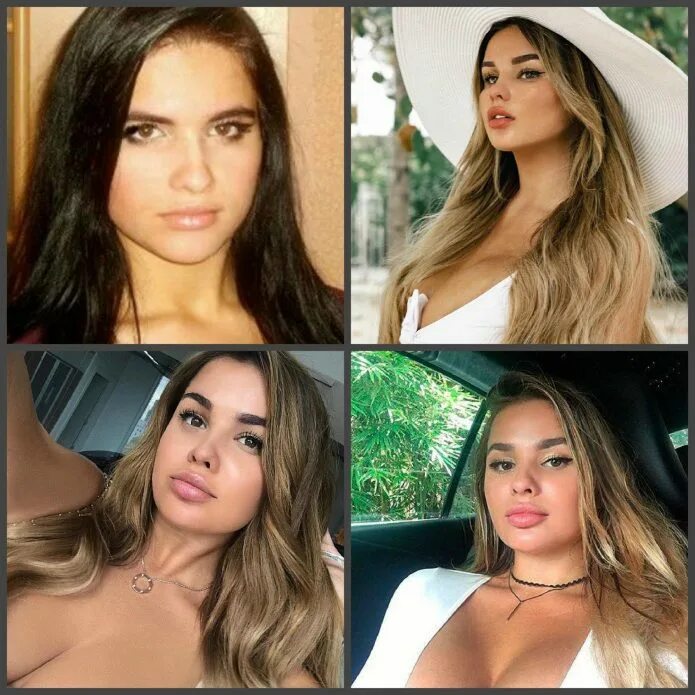 Квитко до и после пластики фото Настя Квитко - фото до и после пластики ddick.ru