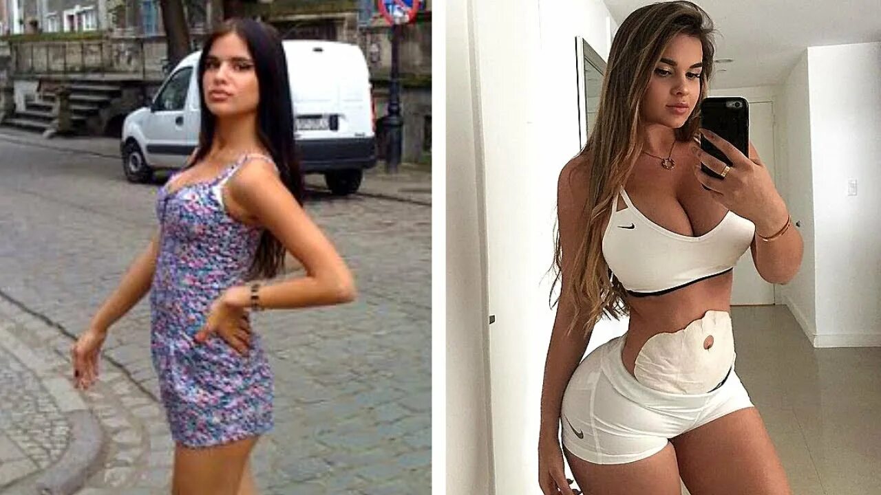 Квитко до и после пластики фото Из Простой Девушки в Модель Показов Канье Уэст - Анастасия Квитко - YouTube