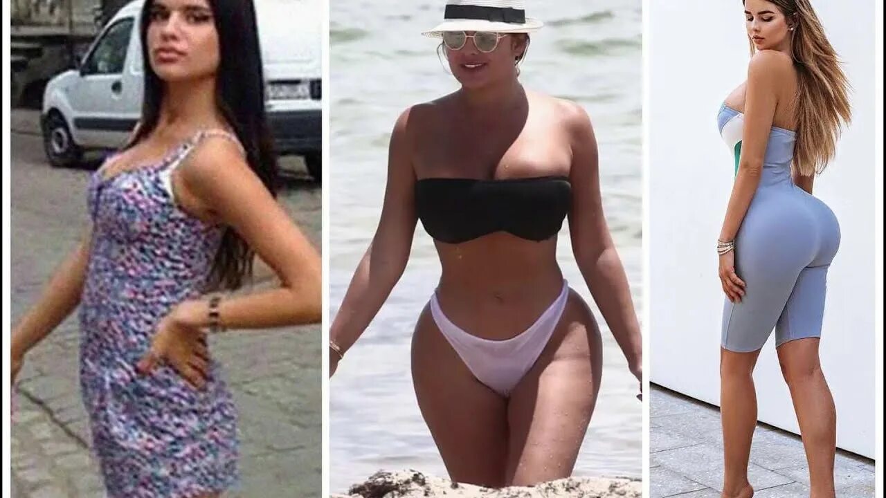 Квитко до и после пластики фото Anastasia Kvitko Facts, Bio, Age, Professional Life, Wiki - YouTube