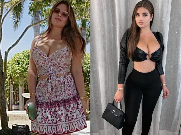 Квитко до и после пластики фото Пухлые руки и пузико: Квитко пришлось показать истинную фигуру Фото & Дизайн Сел