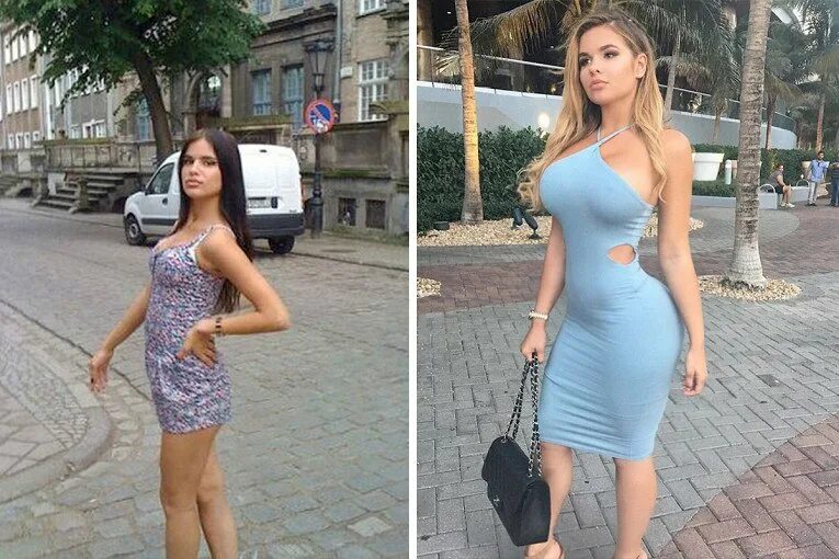 Квитко до и после пластики фото Русская Кардашьян", калининградка Анастасия Квитко, сегодня счастливо проживает 