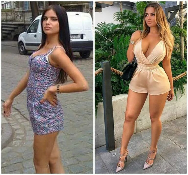 Квитко до и после пластики фото Как до пластики и славы выглядела Анастасия Квитко у которой сейчас свыше 12 млн