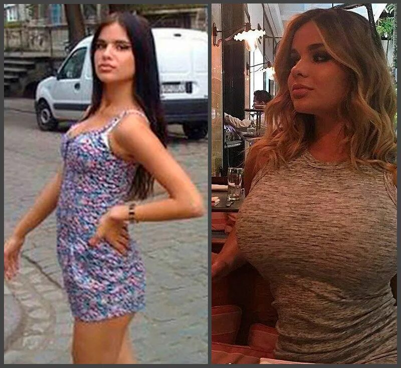 Квитко до и после пластики фото 7 популярных Инстаграмщиц до и после пластики TecRussia.ru Дзен