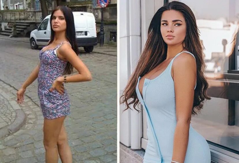 Квитко до и после пластики фото Анастасия Квитко тогда и сейчас: как менялась русская Ким Кардашьян