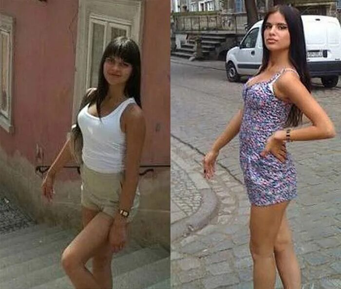 Квитко до и после пластики фото Анастасия Квитко: как стать знаменитой, ничего для этого не делая. Кроме пластик