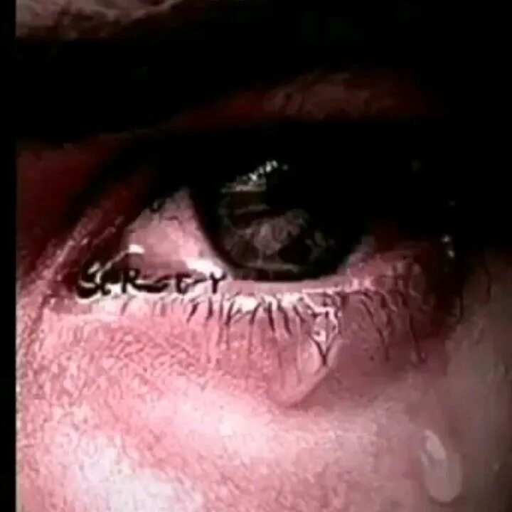 Плачущие глаза фото SeVgİ_GöZ_YaŞiMiDiR? (@yarali_yetim) TikTok