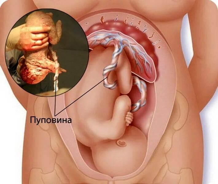 Плацента как выглядит после родов настоящая Funiculus umbilicalis