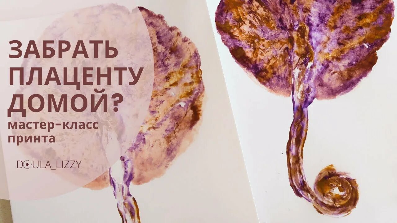 Плацента как выглядит после родов настоящая ЧТО ДЕЛАЮТ С ПЛАЦЕНТОЙ ПОСЛЕ РОДОВ - YouTube