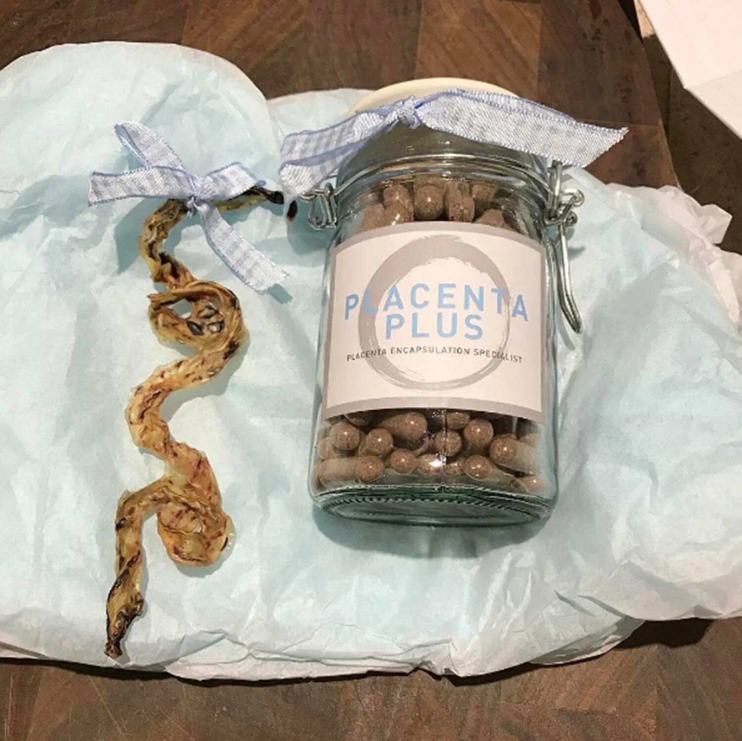 Плацента как выглядит после родов настоящая Mum reveals her panic as meat thief steals PLACENTA from her freezer The Sun