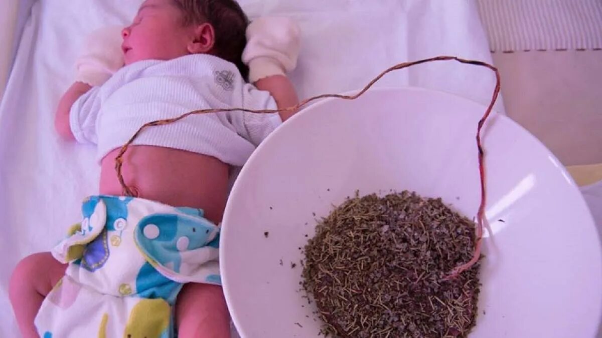 Плацента как выглядит после родов настоящая "Баланың жолдасын жеу дұрыс емес": Отандық дәрігер жас аналарға өз кеңесін айтты