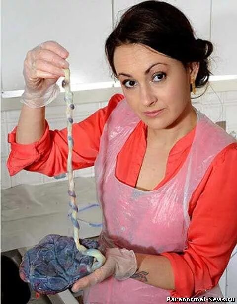 Плацента как выглядит после родов настоящая От послеродовой депрессии спасет...поедание плаценты