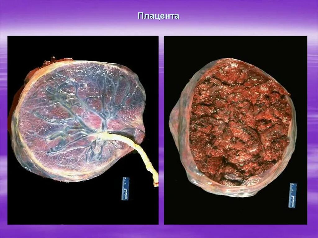 Плацента как выглядит после родов настоящая Плацента для волос: что это, действие ампул с плацентой для волос