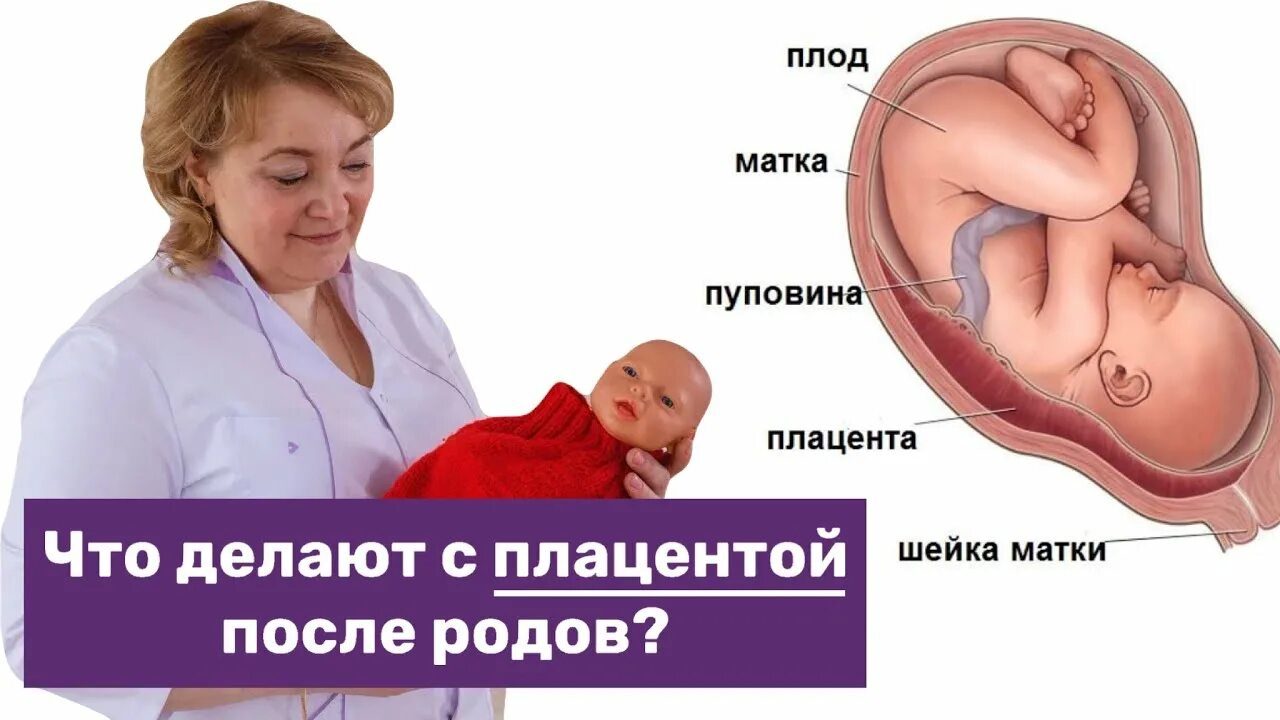Плацента как выглядит после родов настоящая Что делают с плацентой после родов? - YouTube