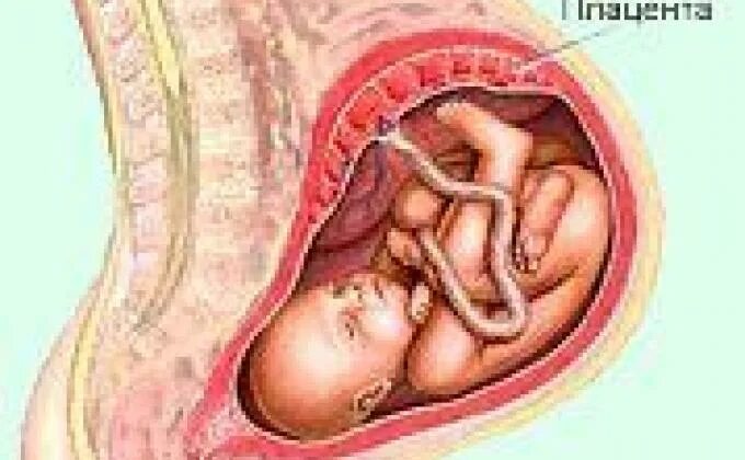 Плацента как выглядит после родов настоящая А вы знаете зачем нужна ПЛАЦЕНТА младенцу и беременной женщине. VEDGARD