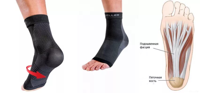 Плацентарный фасциит стопа симптомы и лечение фото Подошвенный фасциит: как облегчить боль - Кладовая Здоровья