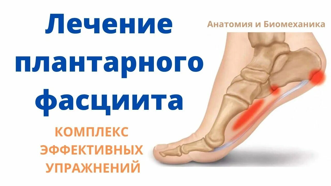 Плацентарный фасциит стопа симптомы и лечение фото Лечение плантарного фасциита. Комплекс упражнений. - YouTube