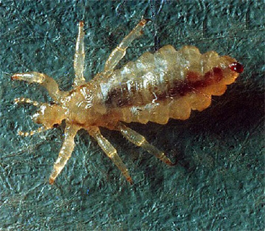 Платяная вошь фото как выглядит укусы Картинки ПЛАТЯНЫЕ ВШИ ЭТО