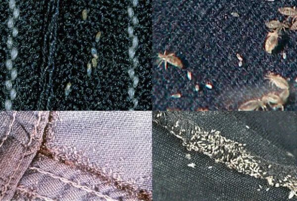 Платяная вошь фото как выглядит укусы Осмотр на педикулез: алгоритм. Первичный и повторный осмотр при педикулезе.