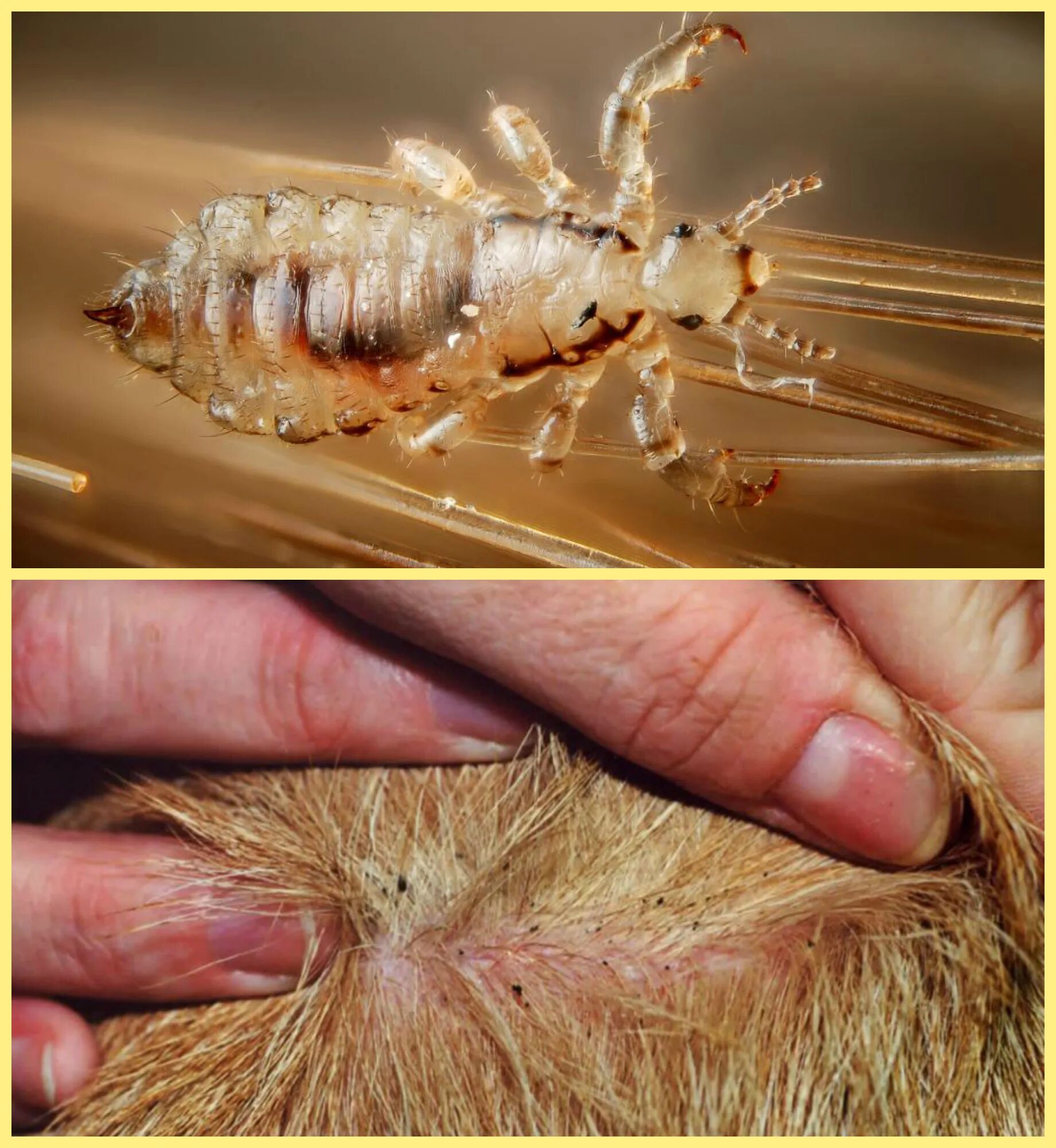 Платяная вошь фото как выглядит укусы Вши кровососущие