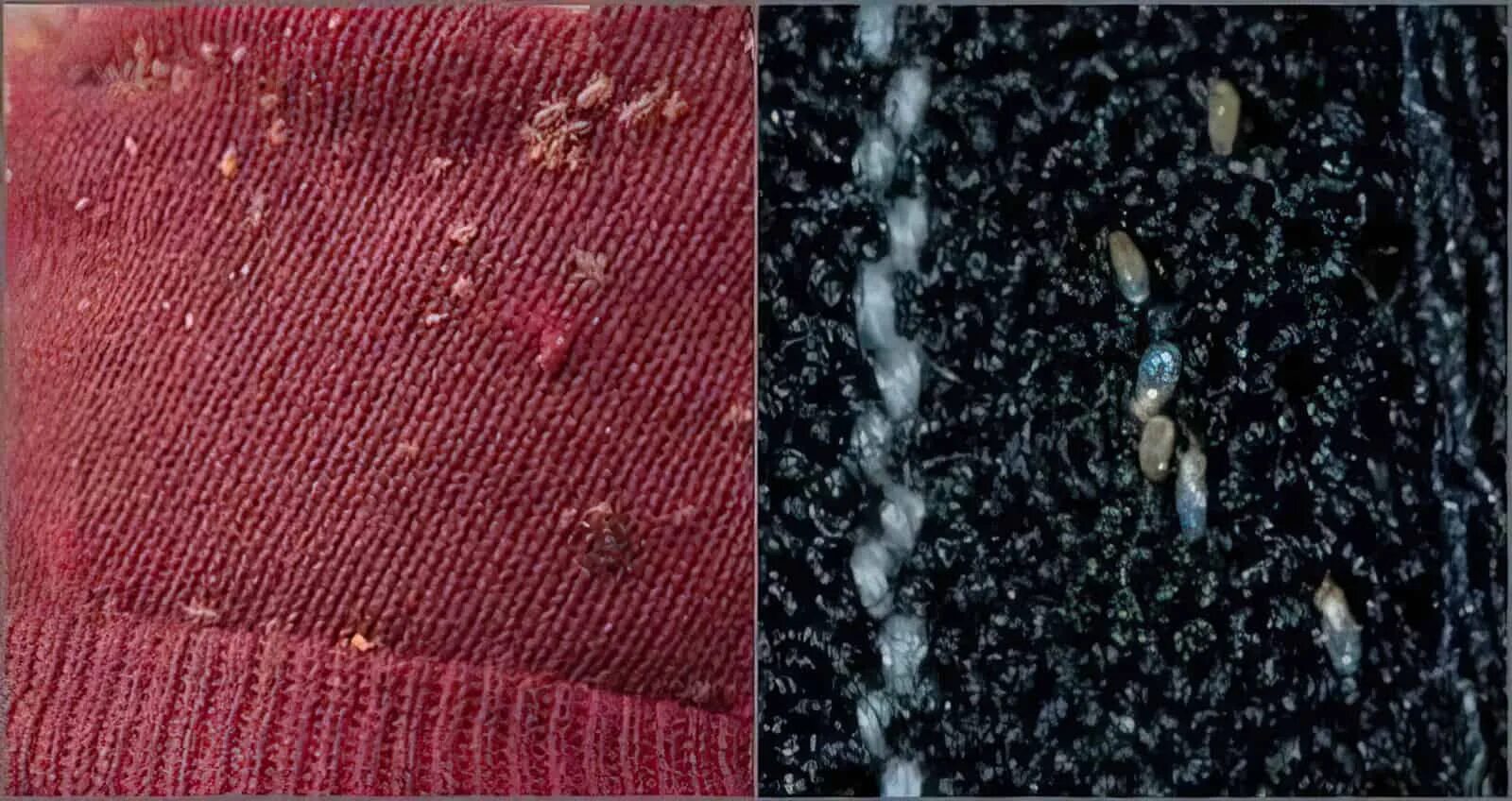 Платяная вошь фото как выглядит укусы Бельевые вши: как выглядят, среда обитания, как размножаются, какую представляют