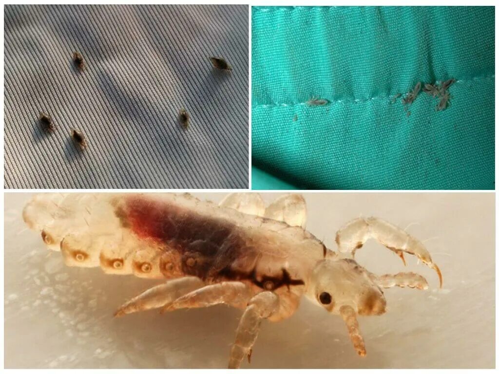 Платяная вошь фото как выглядит укусы Раптор на батарейках от комаров