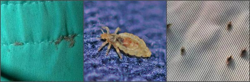 Платяная вошь фото как выглядит укусы Постельные и бельевые блохи: фото паразитов и их укусов, а так же меры борьбы с 
