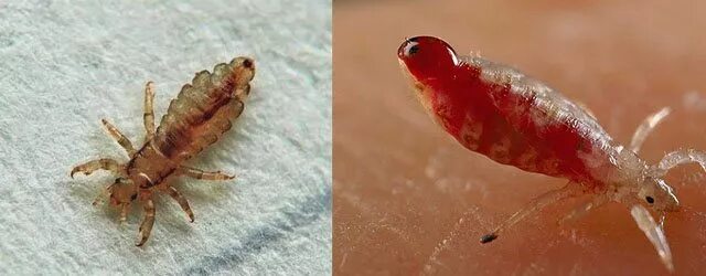 Платяная вошь фото как выглядит укусы Как избавиться от бельевых вшей в домашних условиях промышленными и народными ср