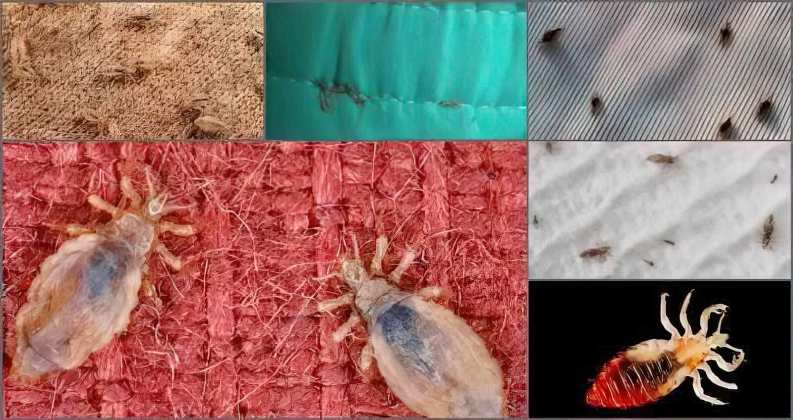 Платяная вошь фото как выглядит укусы Какие виды вшей существуют: что нужно знать о них