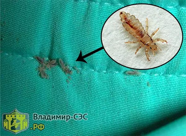 Платяная вошь фото как выглядит укусы Как избавиться от вшей: бельевых, лобковых, в волосах.