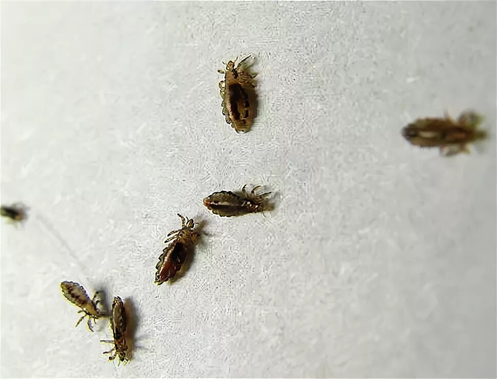 Платяная вошь как выглядят От чего появляются вши на голове: основные причины