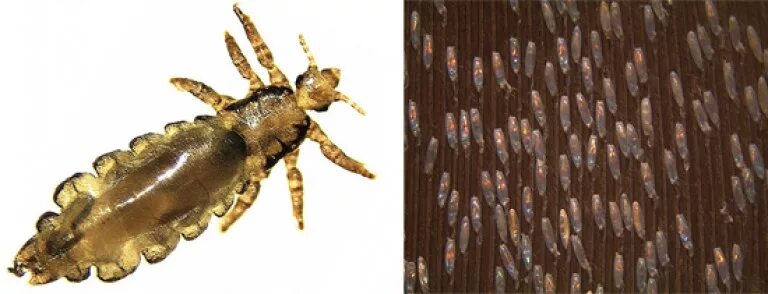 Платяная вошь как выглядят Бельевая вошь как выглядит фото - ViktoriaFoto.ru